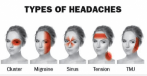Types of Headaches & Migraines 